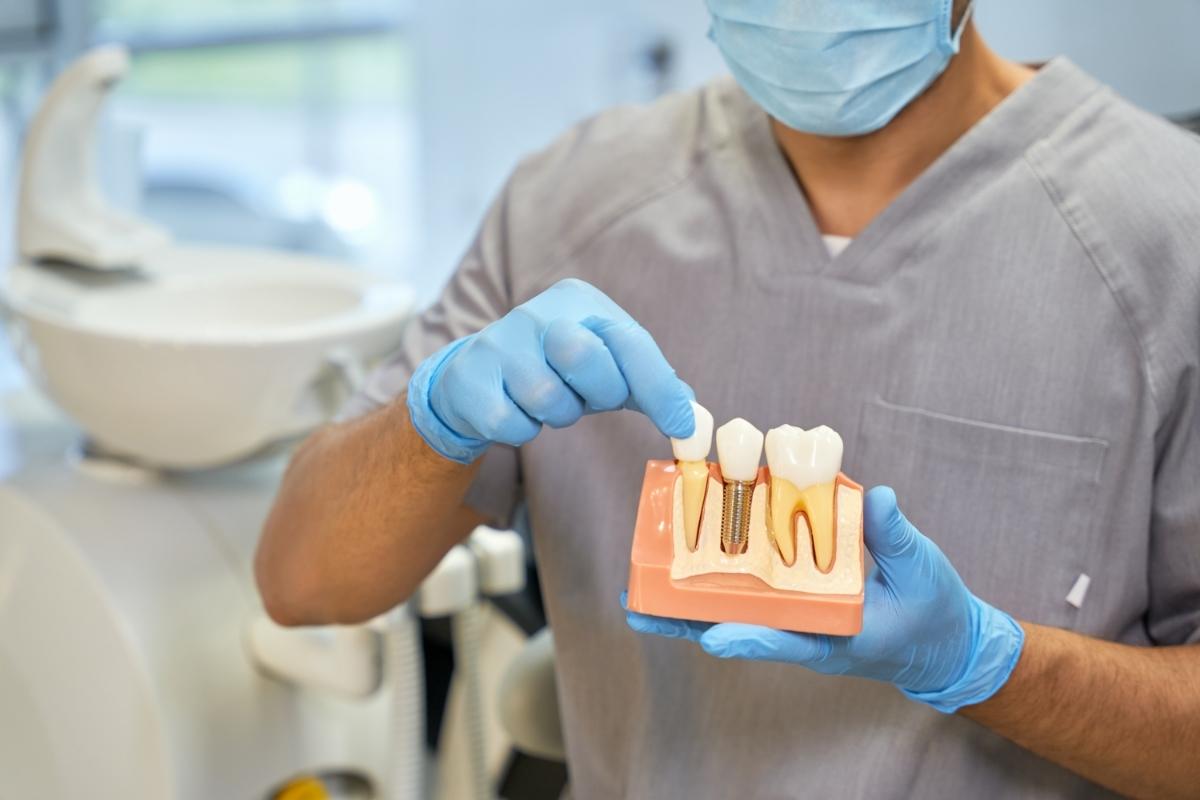 רופא שיניים מומחה להשתלות