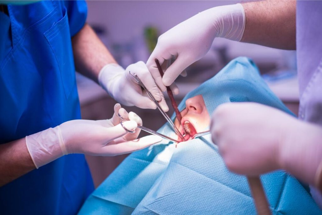כמה עולה עקירה כירורגית של שן בינה